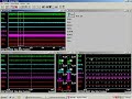 Review Rest EMG
