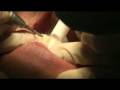 Dental Health Spa - Brighton Dental Health Spa - Brighton