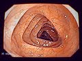 Limpieza Intestinal o Salud Digestiva Limpieza Intestinal o Salud Digestiva