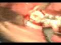 videos de Dental Death - ToothRot