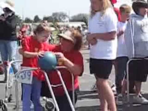 Trisomy-13 Walking with Reverse K walker - Patau Syndrome (full trisomy13)