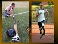 Voluntad de Acero Oscar Pistorius