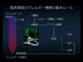 「新しいアレルギー・アトピー臨床の基礎」 Part-2