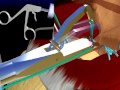 Click to View : Rotator Cuff - Patient Education