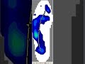 Pedobarography