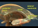 Brain Stem Model - Lateral & Third Ventricles