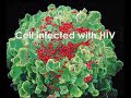 AIDS