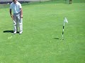 Down syndrome:&nbsp;Down Syndrome: Putting