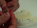 Dental implants continuing education course - placing an abutment using a torque wrench