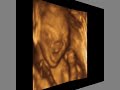 Andriana Baby 21 Weeks 3D 4D Ultrasound - Charlotte, NC