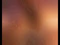 last-days-of-humanity-infinitive-putrefaction-in-progress.html