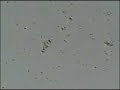 protozoa death
