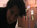 finasteride 5mg Proscar avances 4 años de uso Calvicie y perdida de cabello