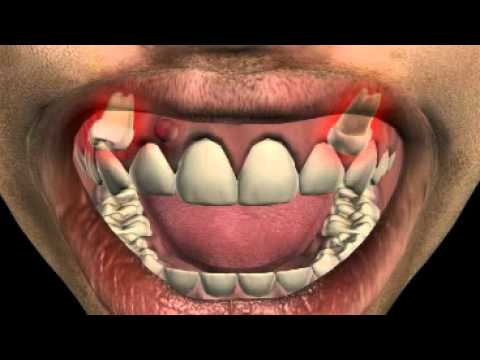 how to isolate tooth pain