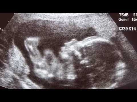 how to help iugr baby grow