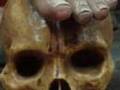 Anatomia Varón de Dolores (2003)