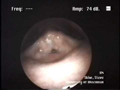 Inside Steve Sklar's Larynx: Sygyt
