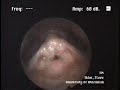 Inside Steve Sklar's Larynx: Sygyt