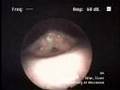 Inside Steve Sklar's Larynx: Sygyt