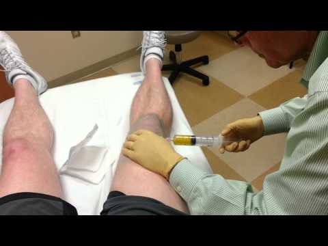 how to drain knee fluid