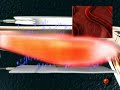 Muscle pain. Watch out how you can soothe muscle pain without taking anti-inflammatory pills Muscle pain. Watch out how you can soothe muscle pain without taking anti-inflammatory pills