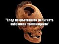 Медицина при древните Българи Трепанация