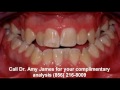 Watch 'Haddonfield NJ Braces - Dr Amy James - Haddon Heights NJ Braces'