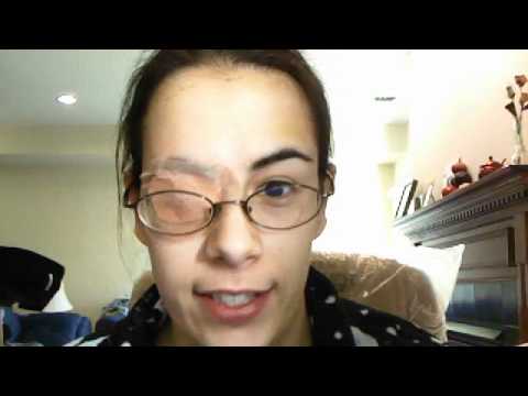 how to patch amblyopia