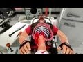 Surgeon Simulator 2013 Team Fortress 2 Trailer