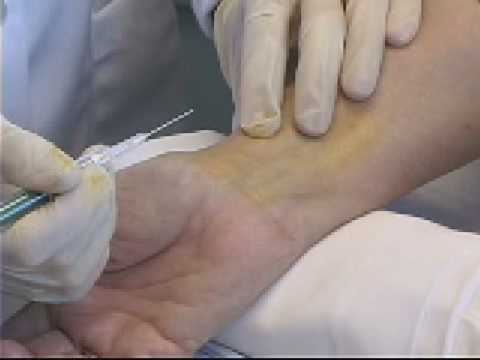 how to collect abg blood sample