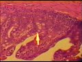 Isospora suis-infected pig intestine