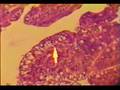 Isospora suis-infected pig intestine