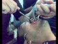 مواقف مضحكة - موقف طريف - انسان غبي - عراقي