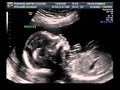 It's a boy! 12/10/12 It's a boy! 12/10/12