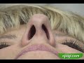 Introduction to the Breeze Nasal Pillow CPAP Mask System Introduction to the Breeze Nasal Pillow CPAP Mask System
