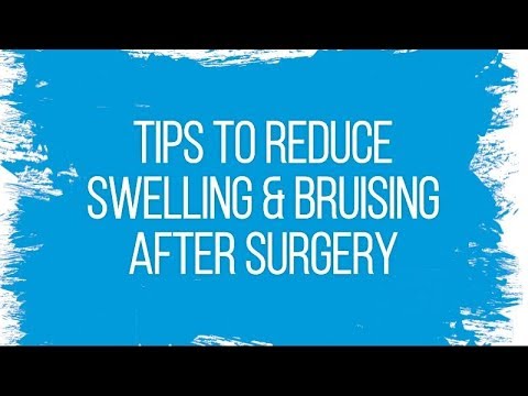 video-linktoworks-Tips to Reduce Swelling & Bruising After Surgery
