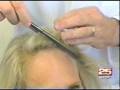 videos de Women's Hair Loss - Journey of Three Women