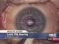 LASIK-risks, lots of risks.....