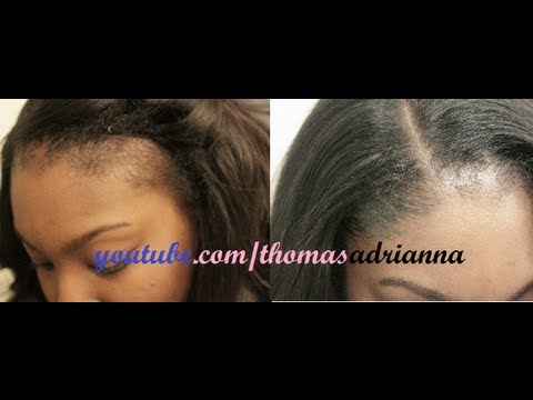 how to grow edges back with sew in