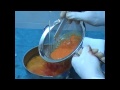 Lipofiller con cellule rigenrative e staminali