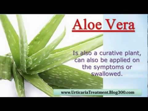 how to treat urticaria