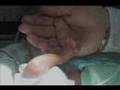 Baby Turners first weeks