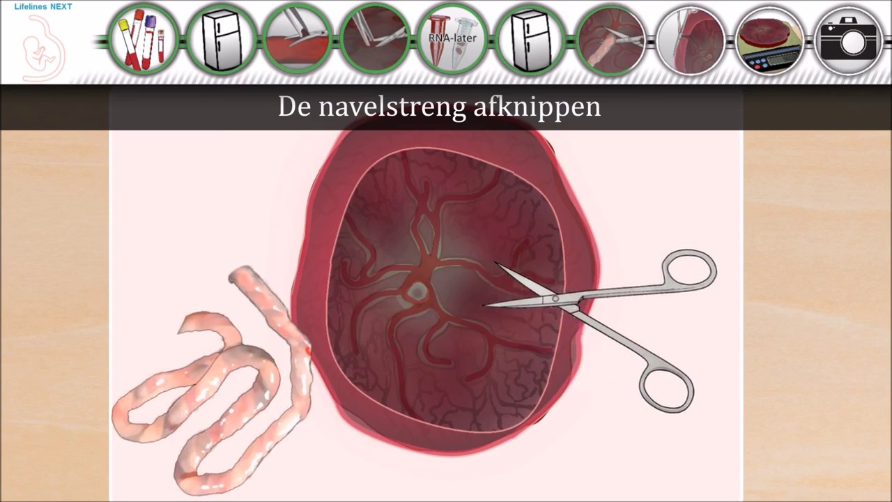 Instructievideo Lifelines NEXT - Verzamelen van Bevallingsamples