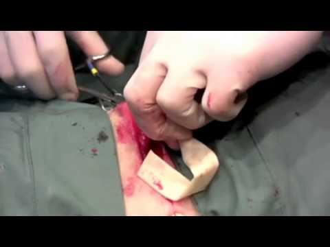 how to cure gingivitis in cats