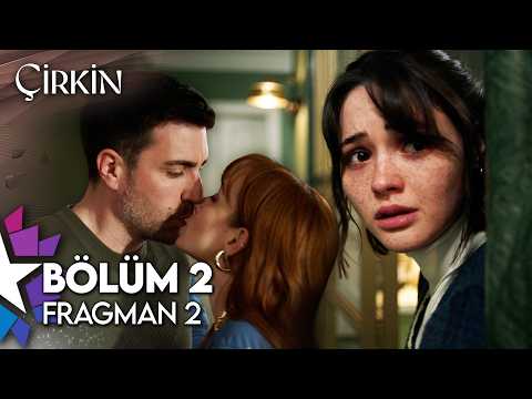 Çirkin 2. Bölüm 2. Fragmanı                                                                                                                                                                                                                               