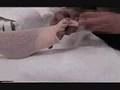 NUPT LID Bandaging VID 3