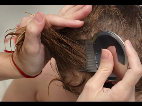 how to remove nits