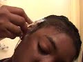 Using shapleys (sulu) for hair growth.