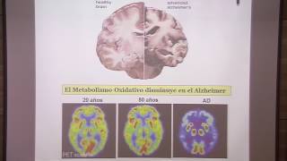 Jornadas Alzheimer