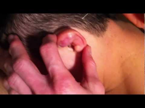 how to drain an ear